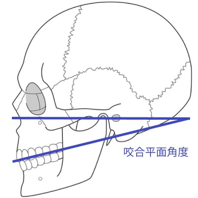 咬合平面角度の解説図